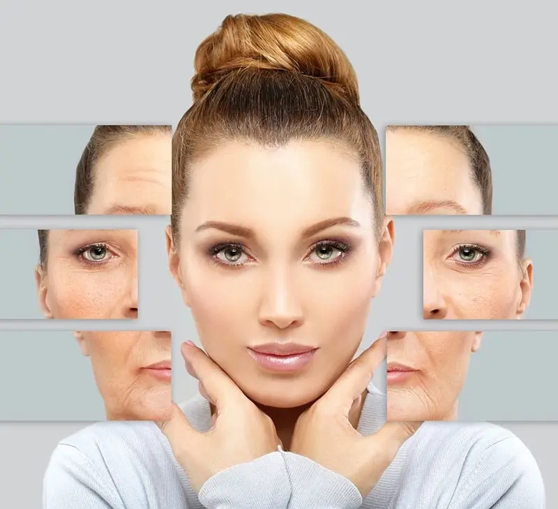 Microneedling